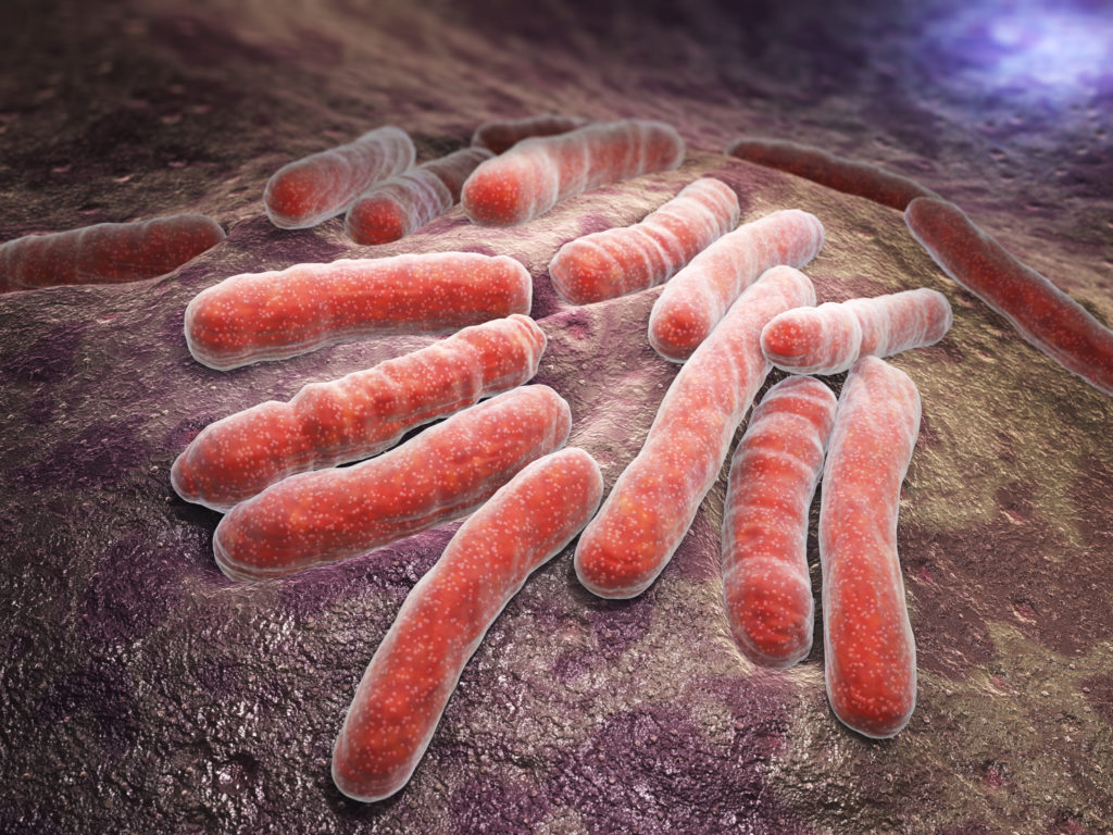 Bacterial infection tuberculosis